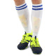 Щитки футбольні KELME 8101HJ5001-9716 S-M жовтий